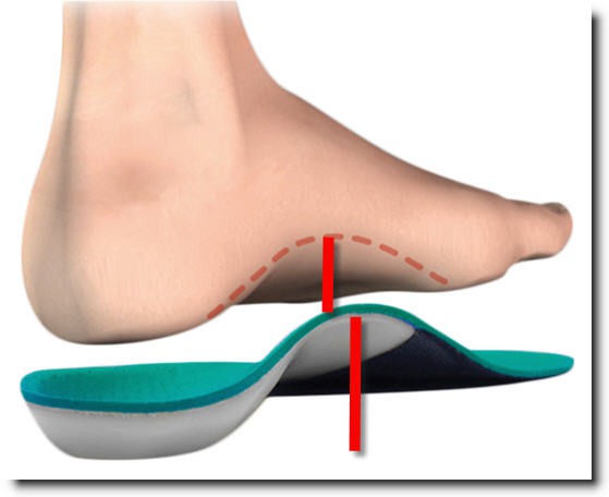 solusi untuk kaki  datar atau flat feet