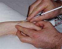 Pengobatan pergelangan tangan sakit di Flex Free Musculoskeletal Rehabilitation Clinic