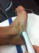 Terapi Ultrasound pada kaki