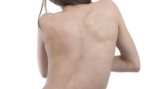 Ke membengkok ke kelainan disebut belakang kanan disebut tulang kondisi bagian atau punggung tulang kiri dimana Pengertian Sistem