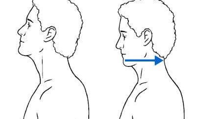 Chin Tuck Charms contoh peregangan pengapuran tulang leher