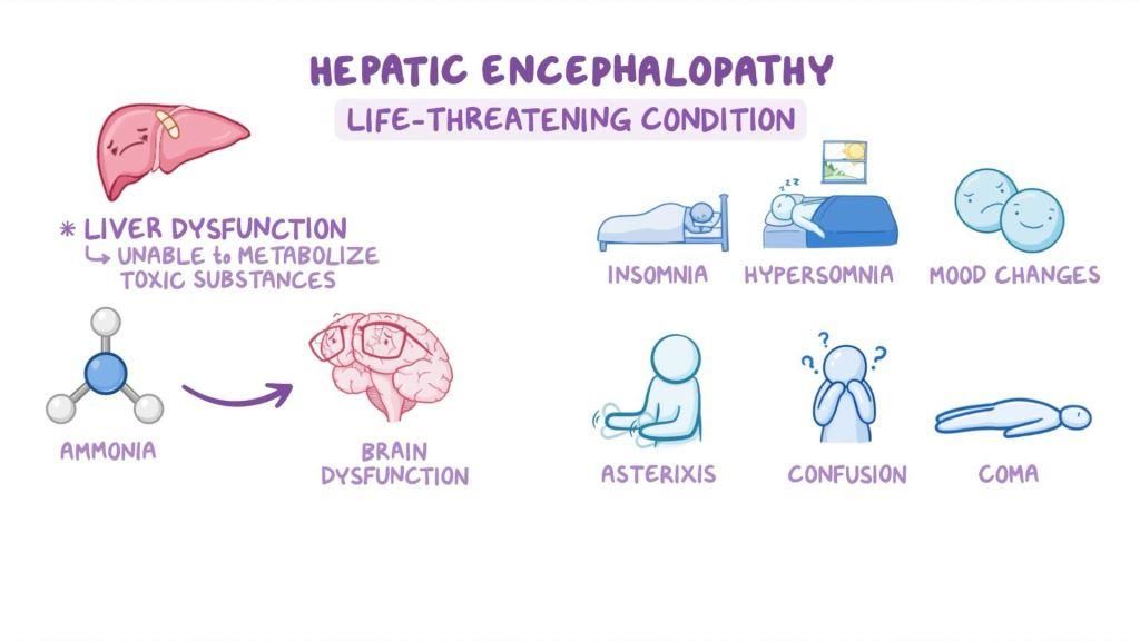gejala penyakit enselopati hepatik