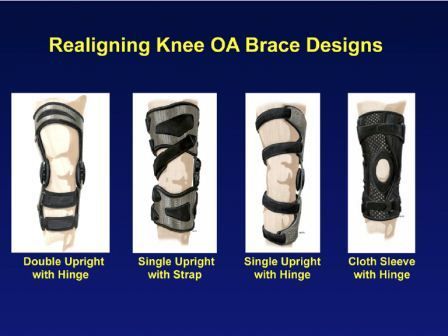 brace lutut osteoarthritis