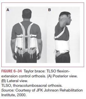 braces skoliosis TLSO