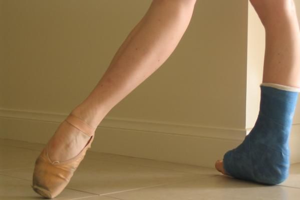 cedera pada penari balet