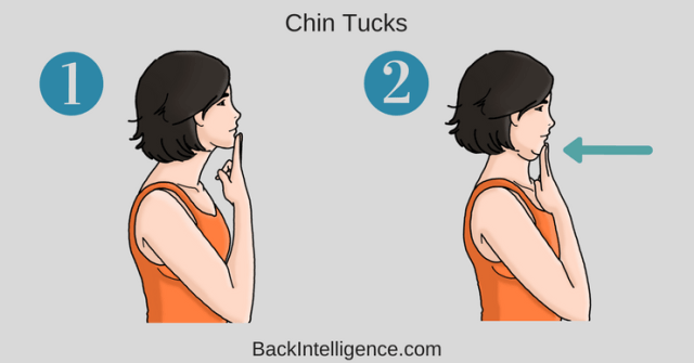 chin tucks