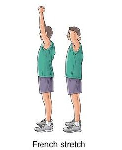 latihan untuk triceps cedera