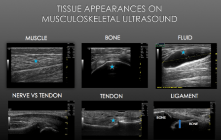 gambaran pemeriksaan ultrasonografi pada cedera