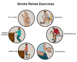 latihan fisioterapi pasca stroke