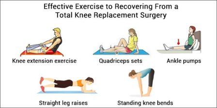 fisioterapi latihan operasi sendi lutut
