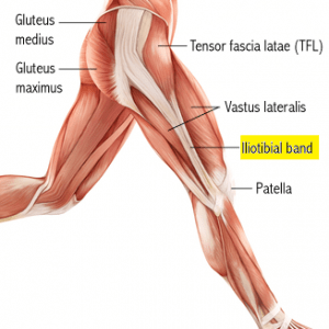 mengenal nyeri lutut bagian luar akibat iliotibial band syndrome