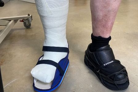 ortosis untuk kaki diabetes