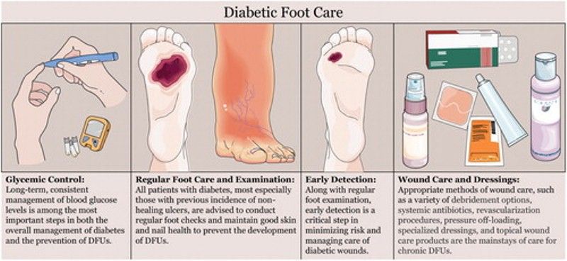 perawatan luka pada telapak kaki karena diabetes