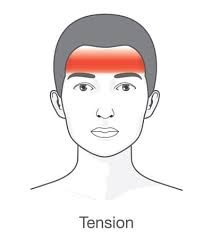 sakit kepala tension