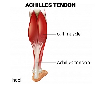 tendon achilles