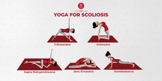 yoga untuk skoliosis